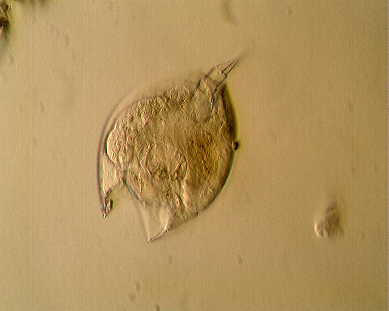 rotifero [ Lepadella sp. ]