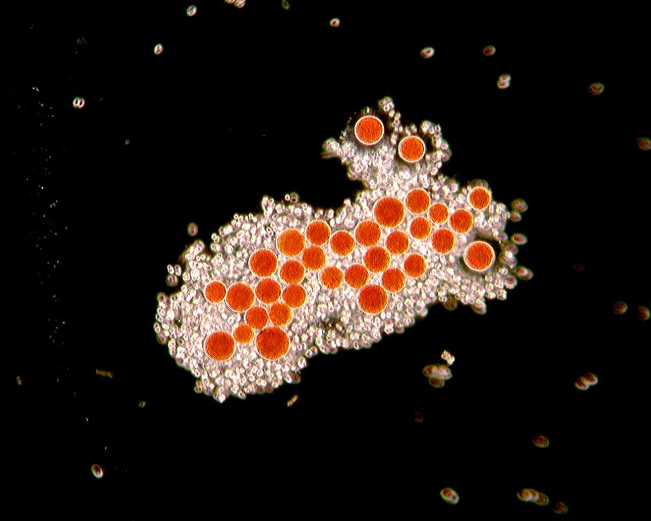 Alga rossa? No, H. pluvialis