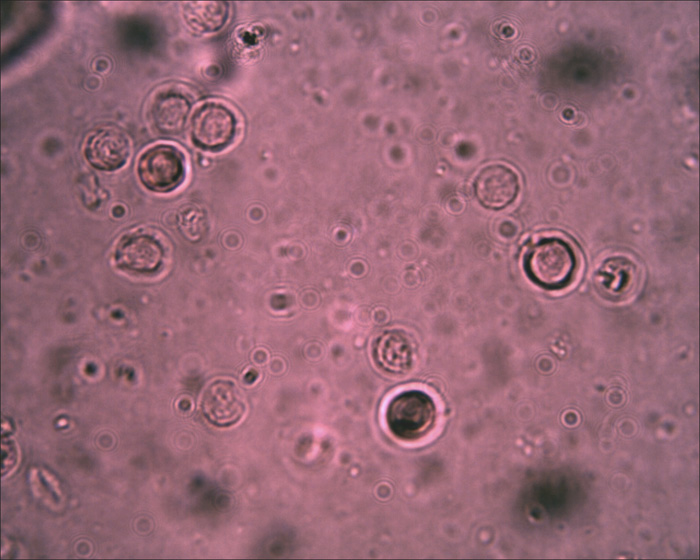 Tephrocybe sphaerospora Khun.& Romagn.