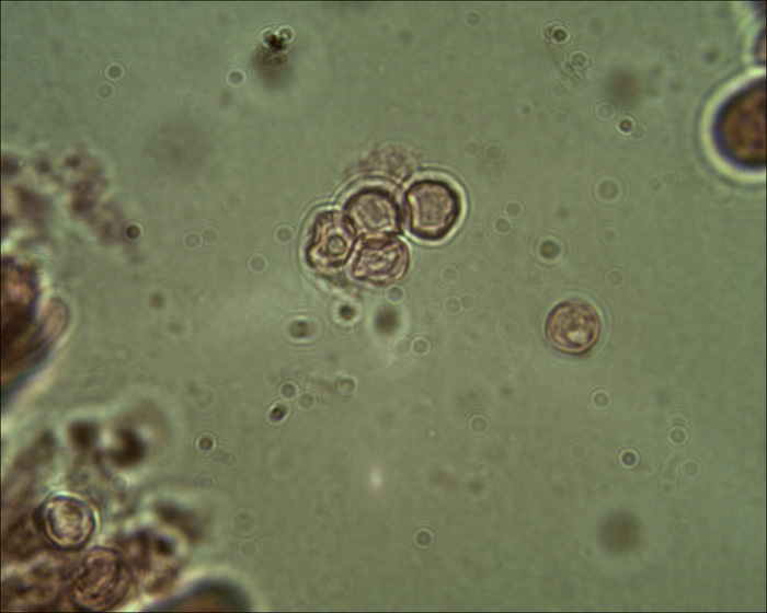 Tephrocybe sphaerospora Khun.& Romagn.