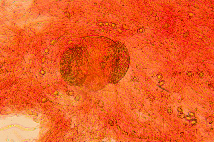 Spiagge Bianche - Fungo dunale 3