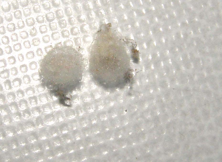 Steatoda triangulosa con ovisacco e piccoli