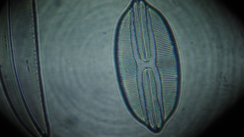 una cosa angosciosa e seria