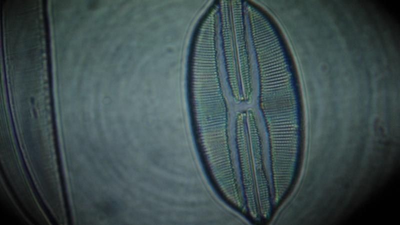 una cosa angosciosa e seria