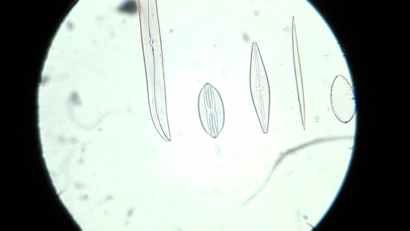 una cosa angosciosa e seria