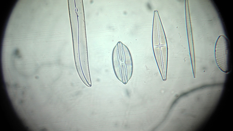 una cosa angosciosa e seria