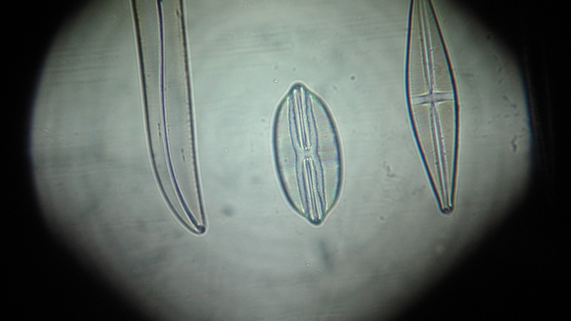 una cosa angosciosa e seria