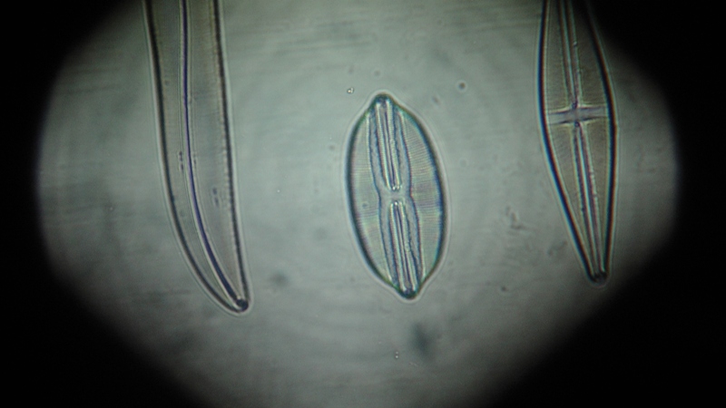 una cosa angosciosa e seria