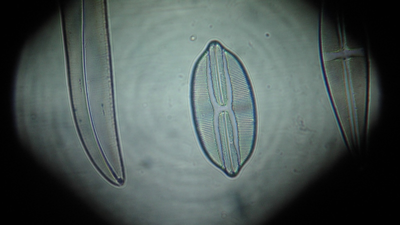 una cosa angosciosa e seria