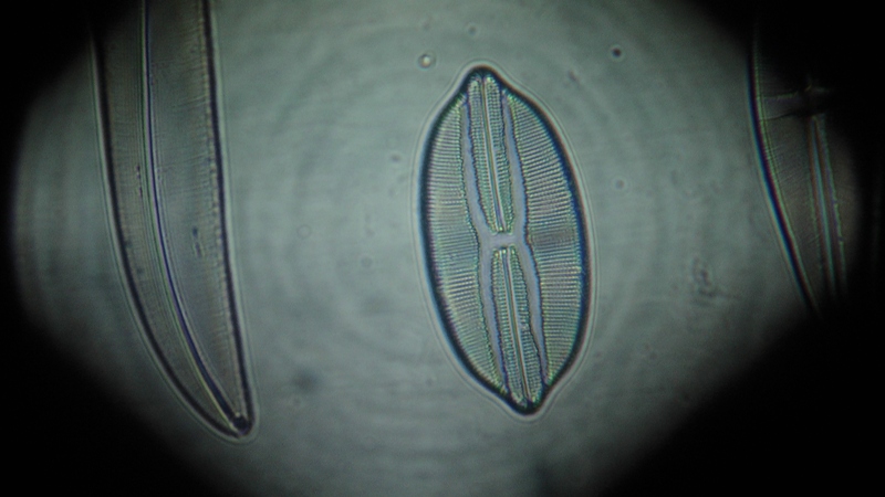 una cosa angosciosa e seria