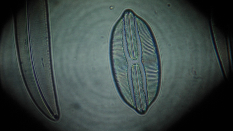 una cosa angosciosa e seria