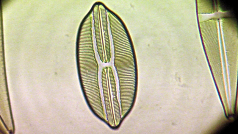 una cosa angosciosa e seria