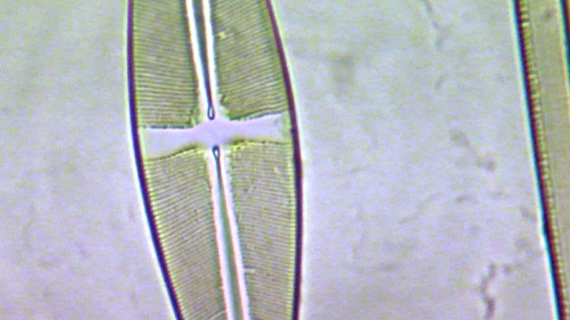 una cosa angosciosa e seria