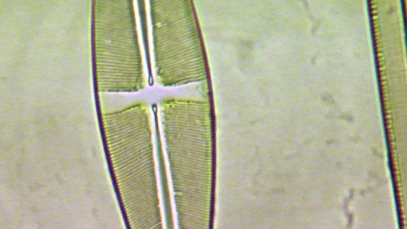 una cosa angosciosa e seria