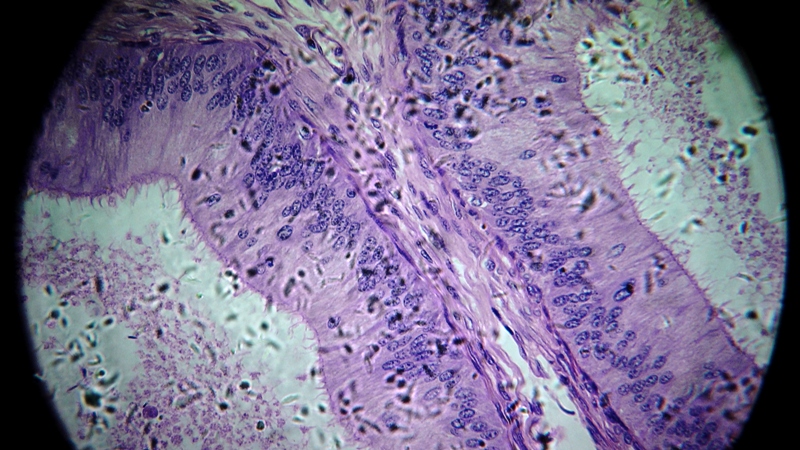 una cosa angosciosa e seria