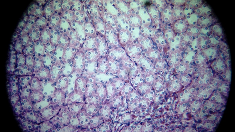 una cosa angosciosa e seria