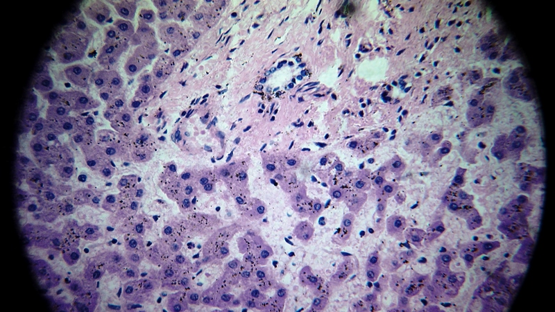 una cosa angosciosa e seria