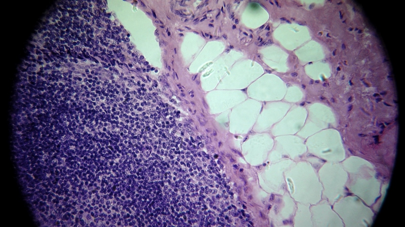 una cosa angosciosa e seria