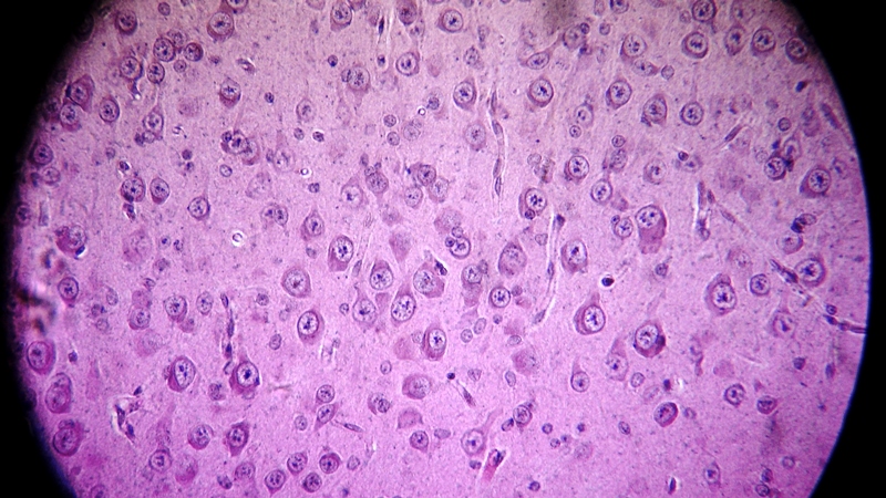 una cosa angosciosa e seria