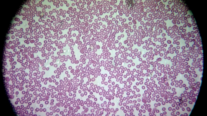 una cosa angosciosa e seria