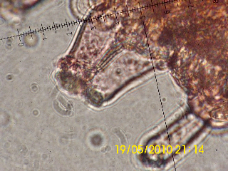 Inocybe da determinare