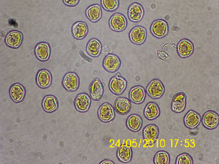 Puccinia?