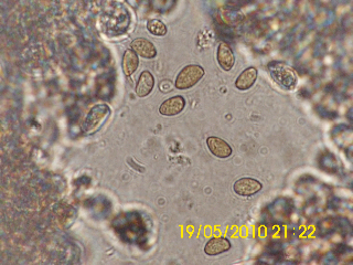 Inocybe da determinare