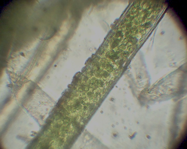 La mia prima foto in microscopia: Aegagropila linnaei