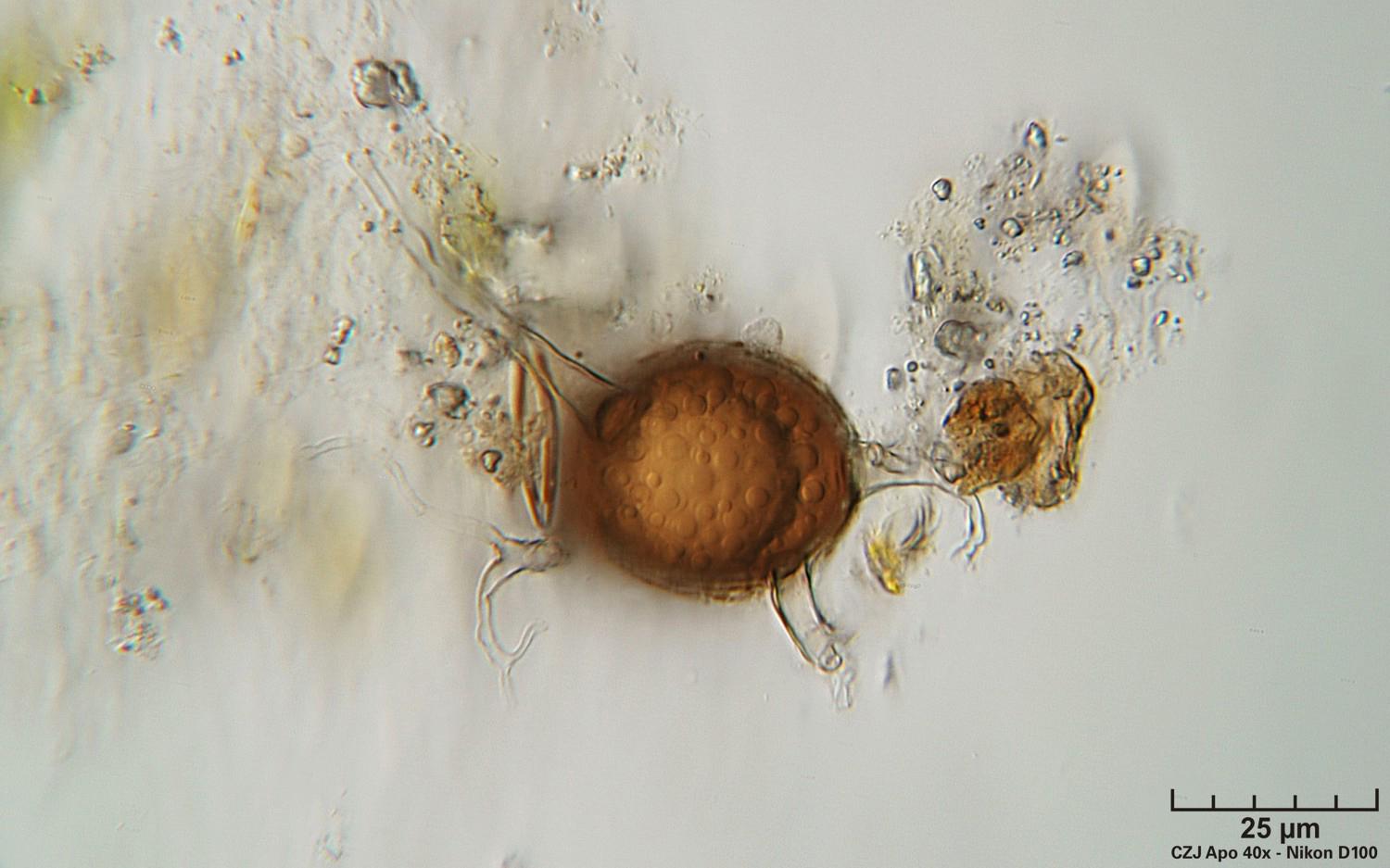 Spore, pollini o tecamebe?