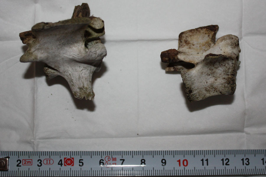 identificazione vertebre