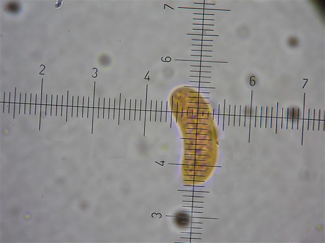 Vuilleminia (Vuilleminia comedens)
