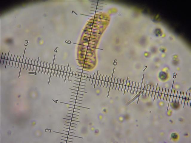 Vuilleminia (Vuilleminia comedens)