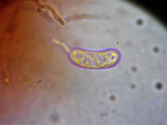 Vuilleminia (Vuilleminia comedens)