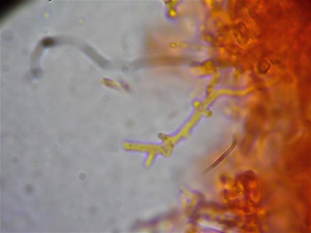 Vuilleminia (Vuilleminia comedens)