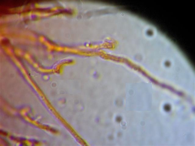Vuilleminia (Vuilleminia comedens)
