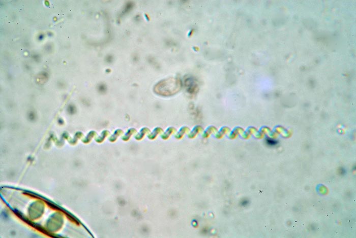 Cianoficea