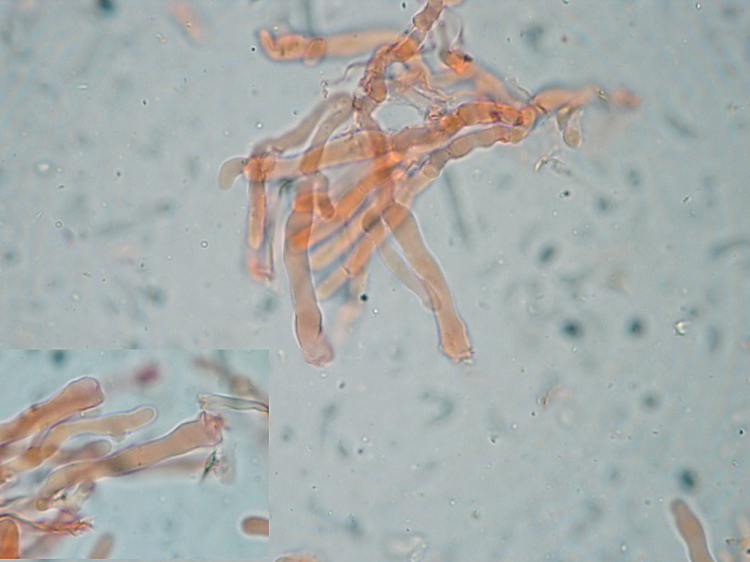 Phanerochaete queletii (Bres.) Nakasone (Esame del typus)