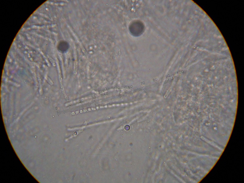 Clavariadelphus ligula?