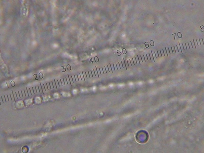 Clavariadelphus ligula?