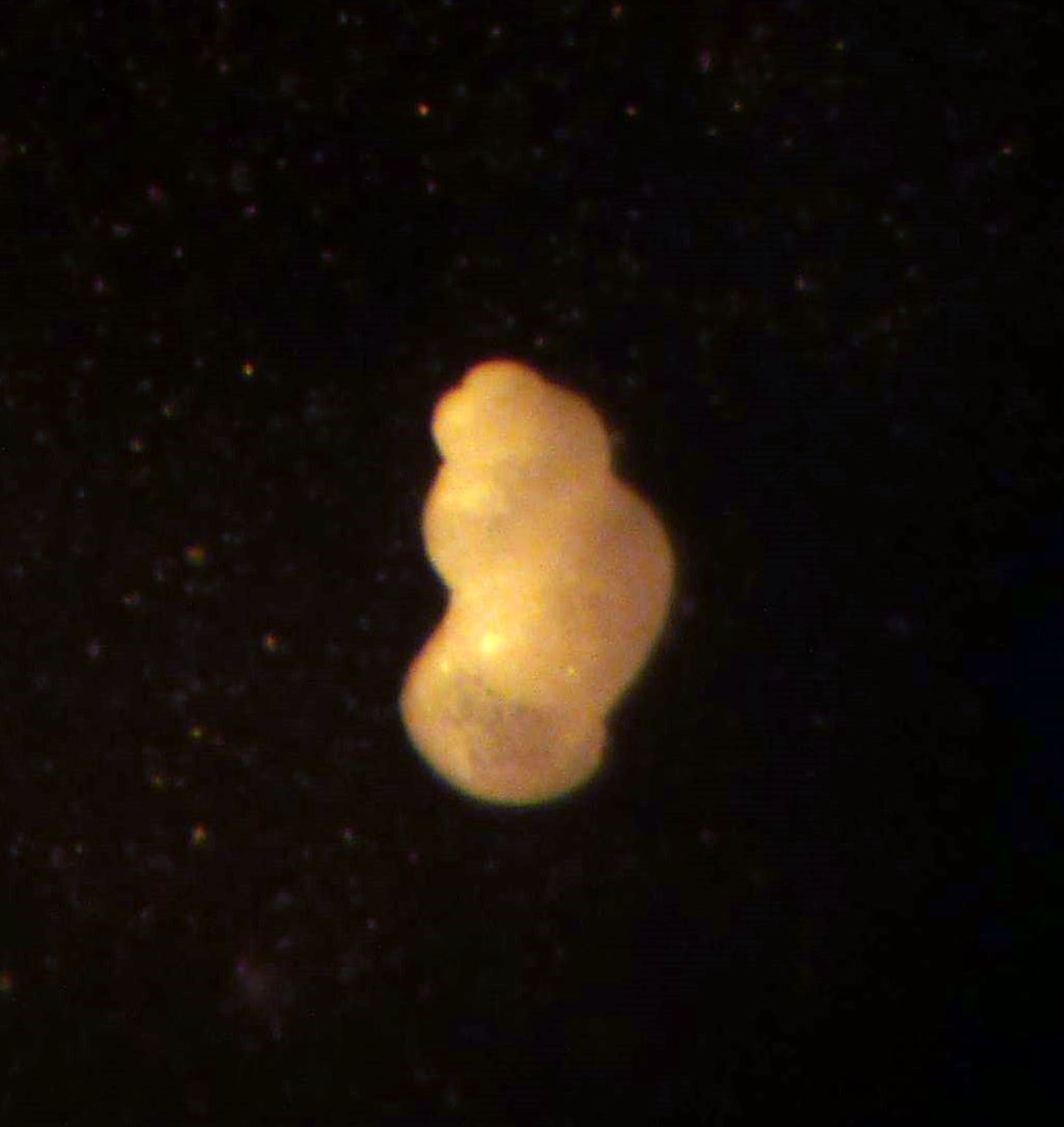 Nodulus contortus?