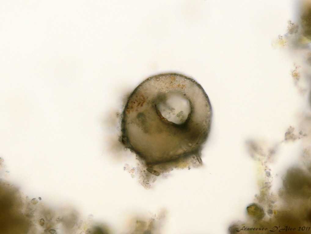 Centropyxis aculeata