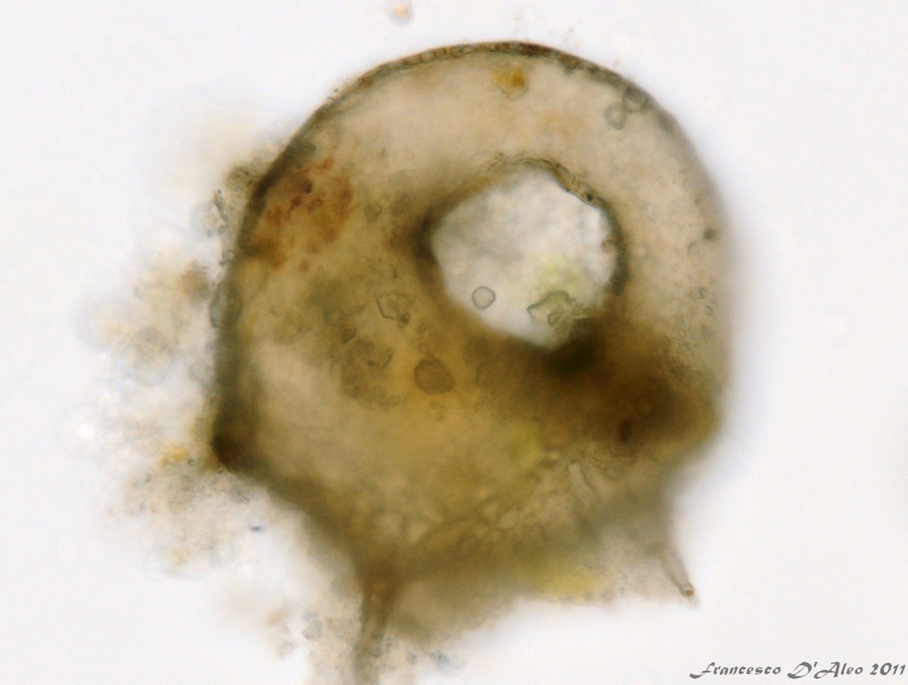 Centropyxis aculeata