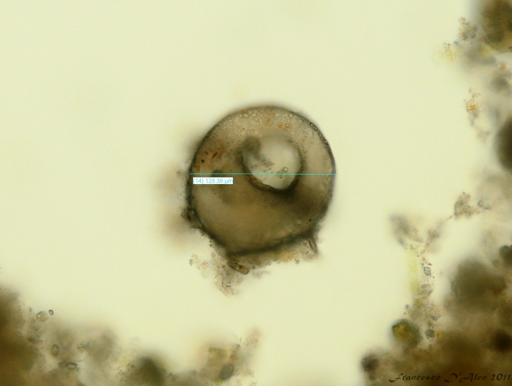 Centropyxis aculeata