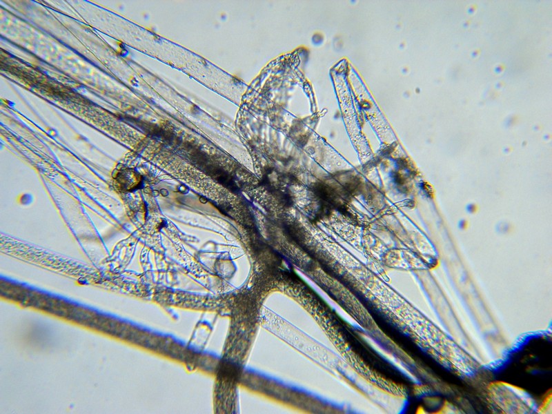 Rhizopus stolonifer