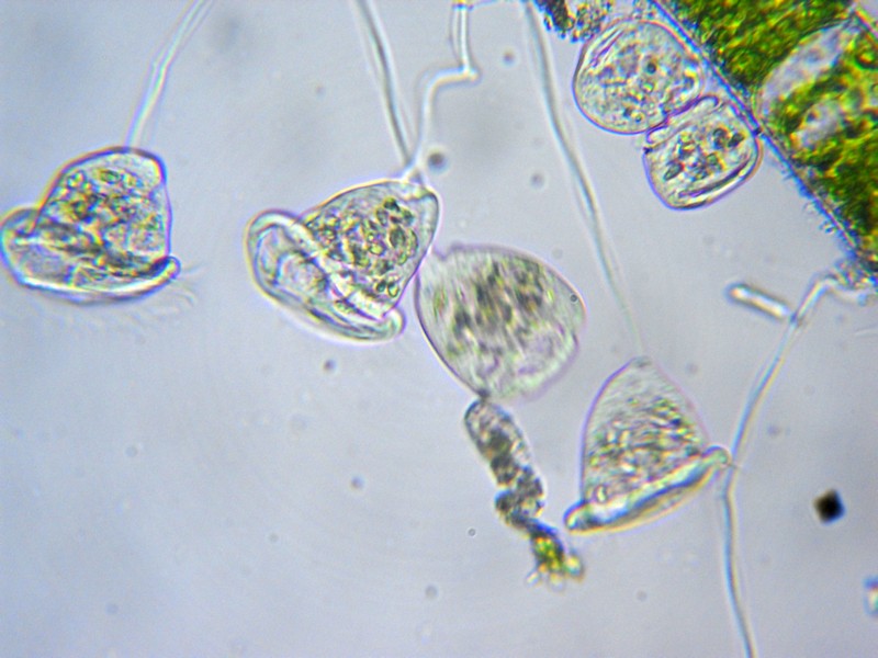 Vorticella sp. (forse similis)