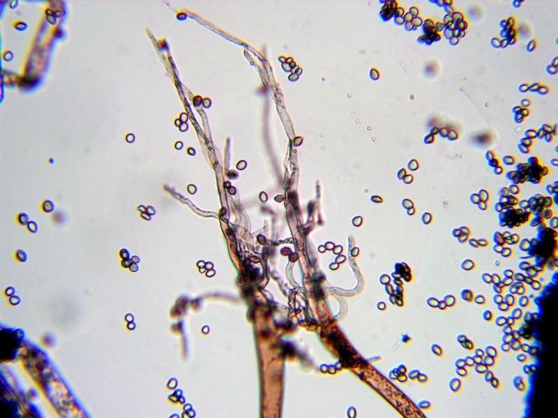 Rhizopus stolonifer