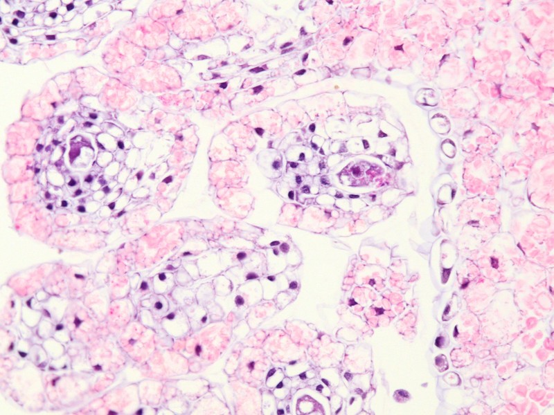 Istologia dell''ovario di Orobanche ramosa