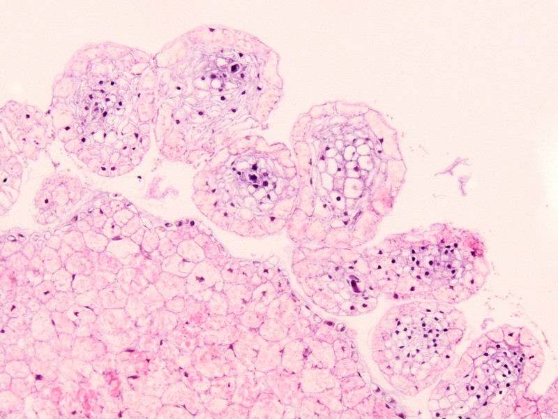 Istologia dell''ovario di Orobanche ramosa