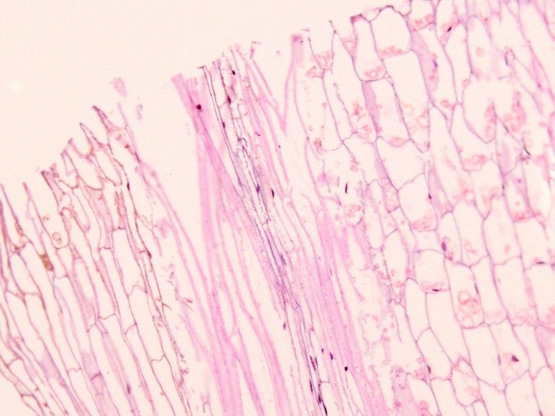 Istologia del fusto di Orobanche ramosa