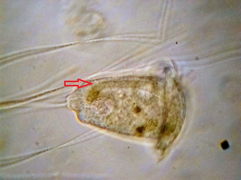 Macronucleo Vorticella